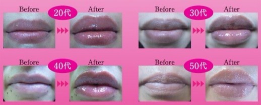 Гель для увеличения объёма губ Япония